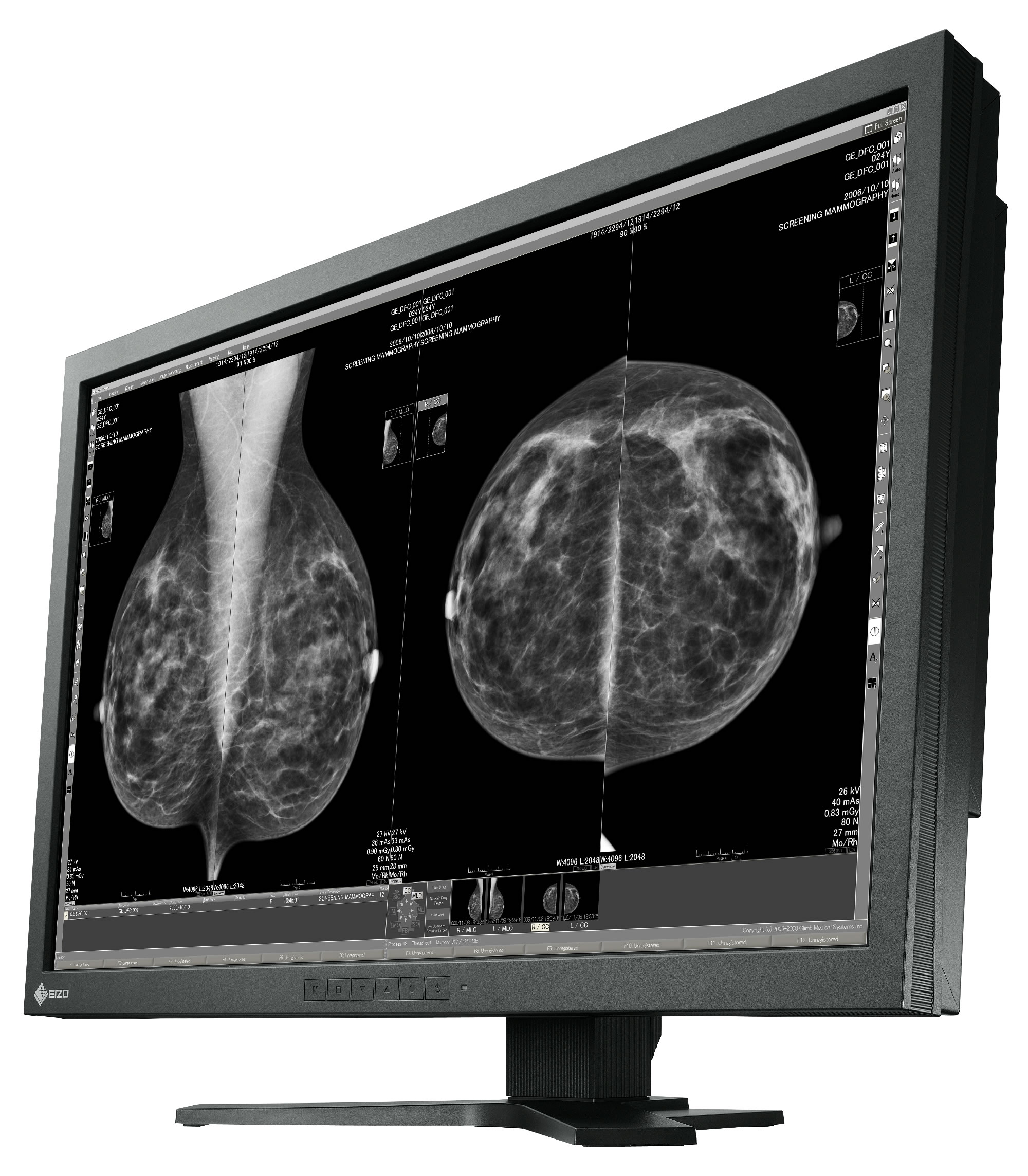 EIZO Introduces 10 MP Widescreen Digital Mammography Monitor, EIZO GmbH